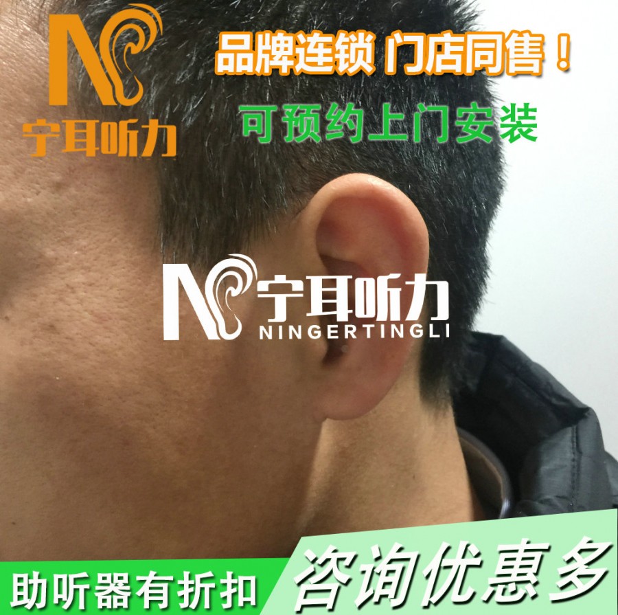 ReSound  vea悦莺ve310-p助听器报价宁耳优惠多