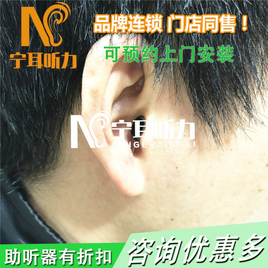  resound 瑞聪 vero vo530-muw助听器好吗