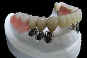 Dental Lab | Denture Lab | Digital Dental Lab | Dental Crown Lab